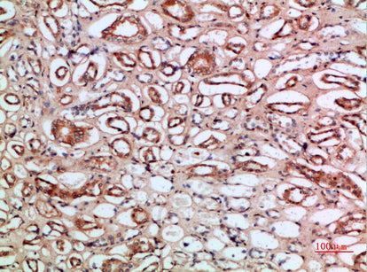 Tetranectin Rabbit Polyclonal Antibody