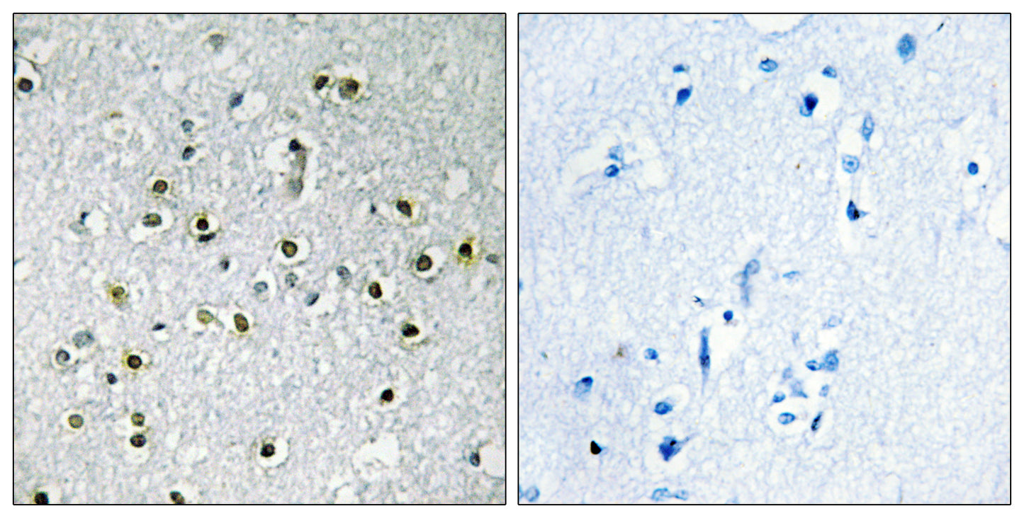 TFE3 Rabbit Polyclonal Antibody