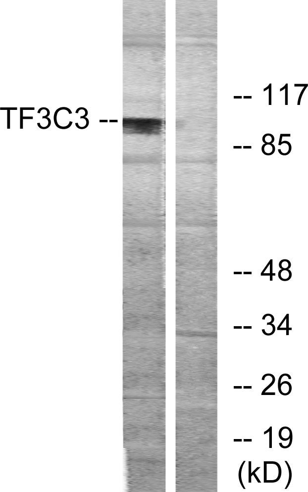 TFIIIC102 Rabbit Polyclonal Antibody
