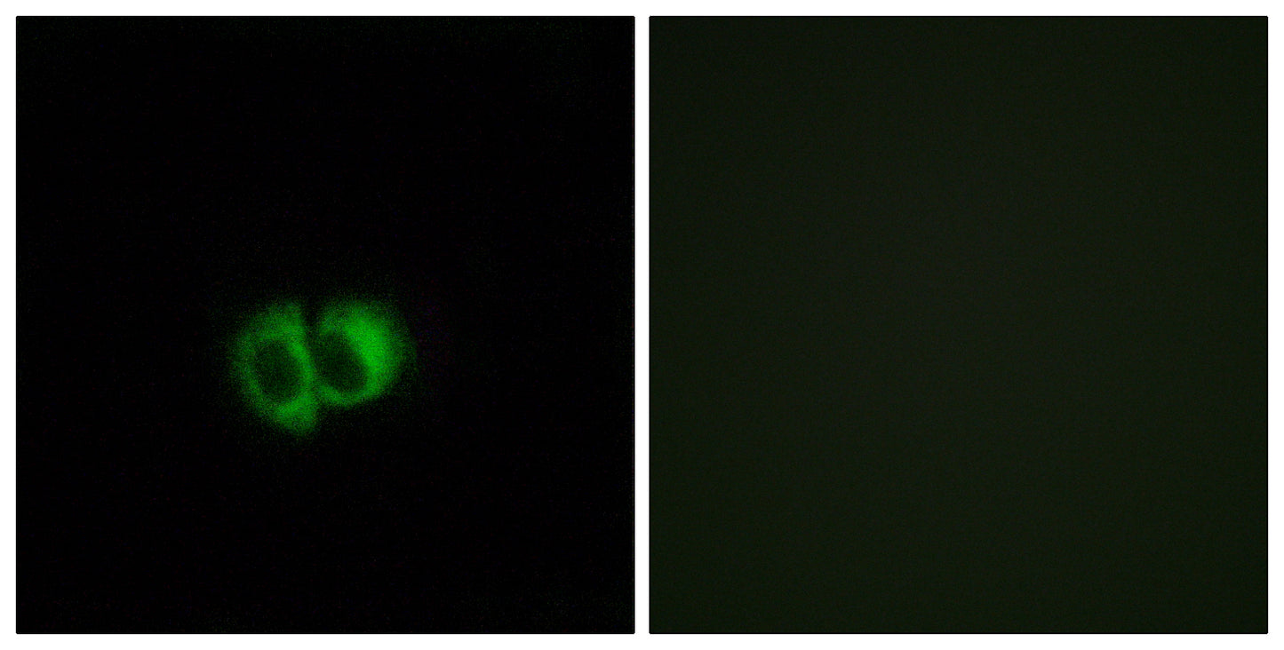 TG1019 Rabbit Polyclonal Antibody