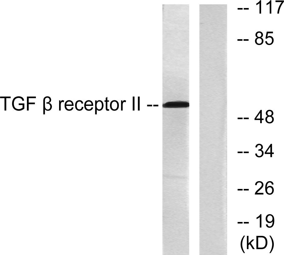 TGFβ RII Rabbit Polyclonal Antibody