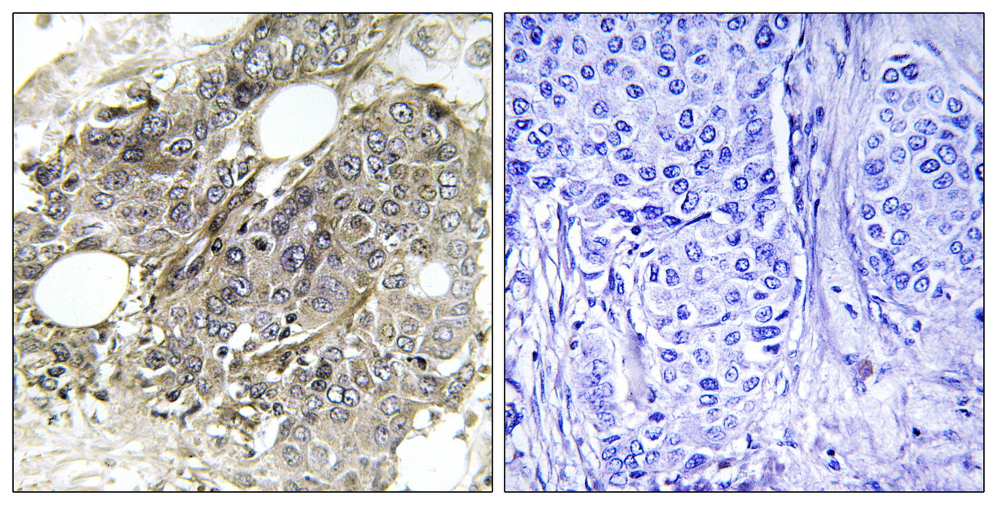 TGFβ RIII Rabbit Polyclonal Antibody