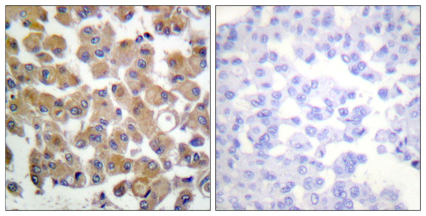 TGFβ1 Rabbit Polyclonal Antibody