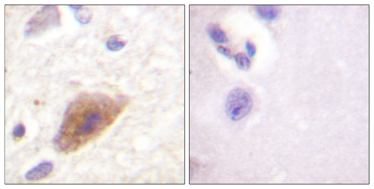 TH Rabbit Polyclonal Antibody