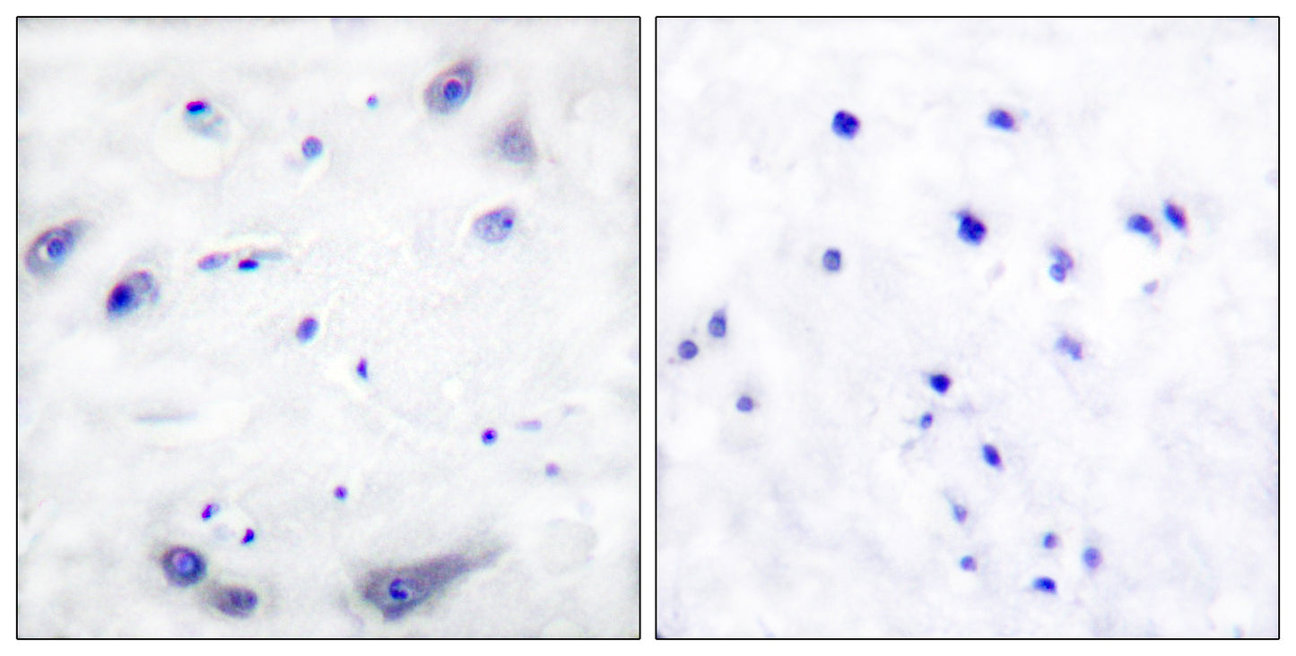 TH Rabbit Polyclonal Antibody