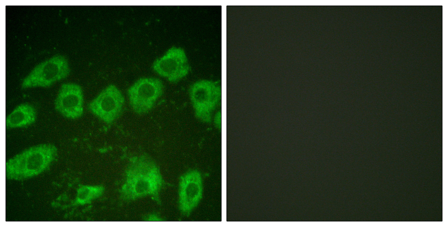 TH Rabbit Polyclonal Antibody