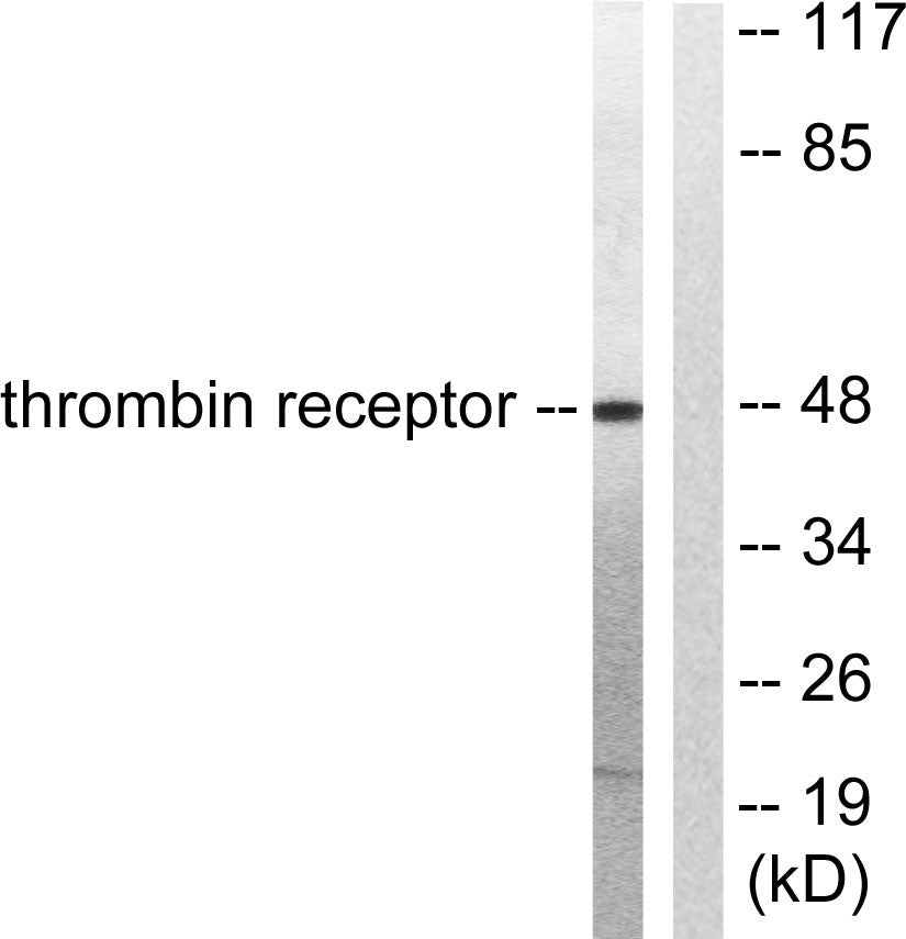 Thrombin R Rabbit Polyclonal Antibody