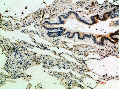 Thrombospondin 4 Rabbit Polyclonal Antibody