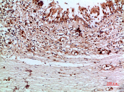 Thyroglobulin Rabbit Polyclonal Antibody