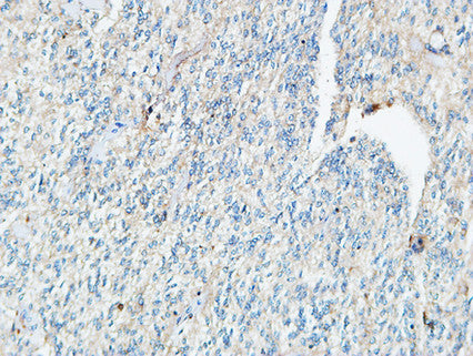 Tie-1 Rabbit Polyclonal Antibody