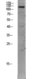 TIE2 Rabbit Polyclonal Antibody