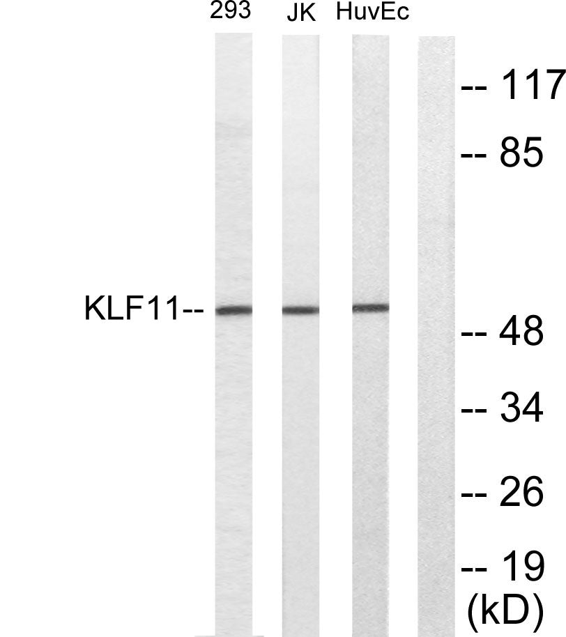 TIEG2 Rabbit Polyclonal Antibody