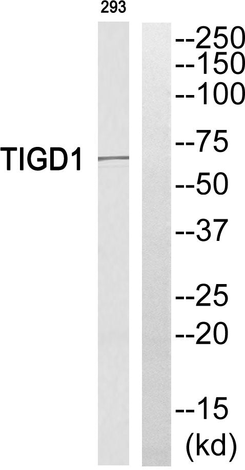 TIGD1 Rabbit Polyclonal Antibody