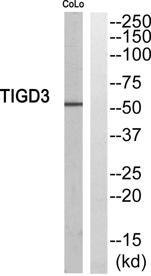 TIGD3 Rabbit Polyclonal Antibody