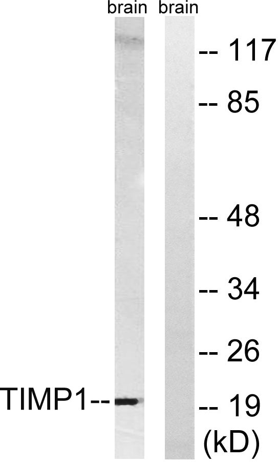 TIMP-1 Rabbit Polyclonal Antibody