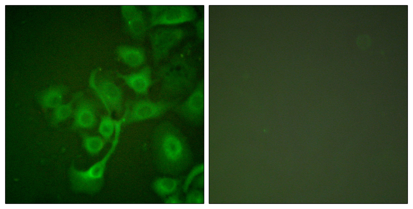 TIMP-2 Rabbit Polyclonal Antibody