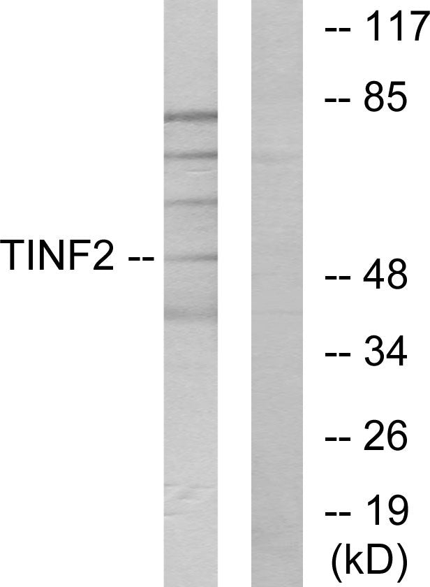 TIN2 Rabbit Polyclonal Antibody