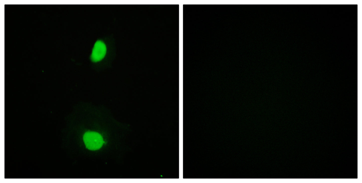 TIP60 Rabbit Polyclonal Antibody