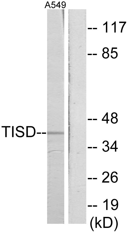 TIS11D Rabbit Polyclonal Antibody