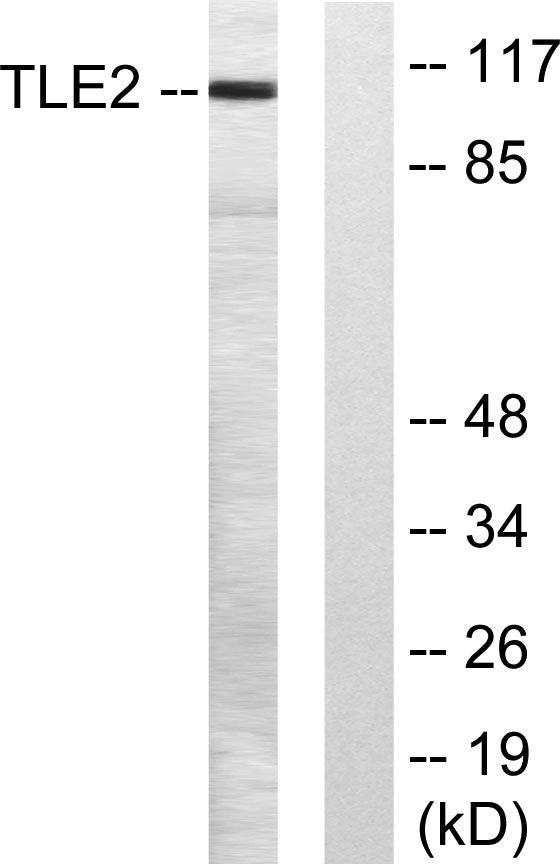 TLE2 Rabbit Polyclonal Antibody