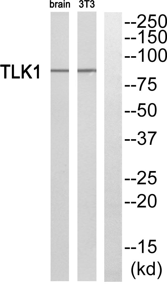 TLK1 Rabbit Polyclonal Antibody