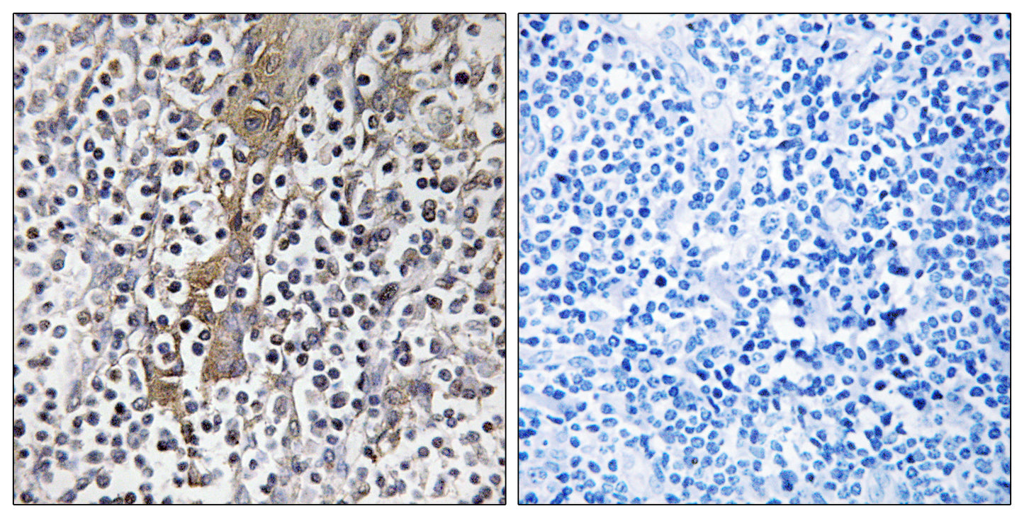 TMC8 Rabbit Polyclonal Antibody