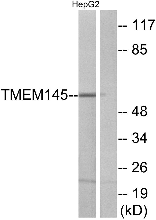 TMEM145 Rabbit Polyclonal Antibody