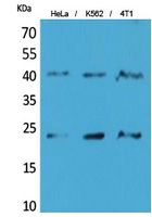 TMEM173 Rabbit Polyclonal Antibody