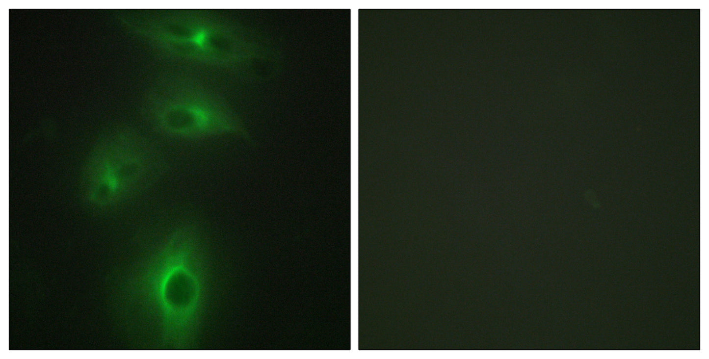 TMPRSS3 Rabbit Polyclonal Antibody