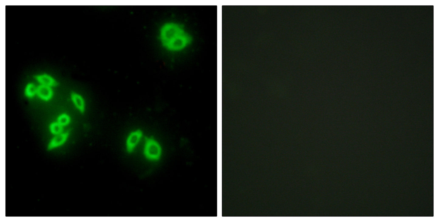 TNF-IP 8 Rabbit Polyclonal Antibody