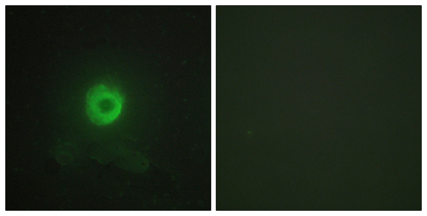 TNF-R2 Rabbit Polyclonal Antibody