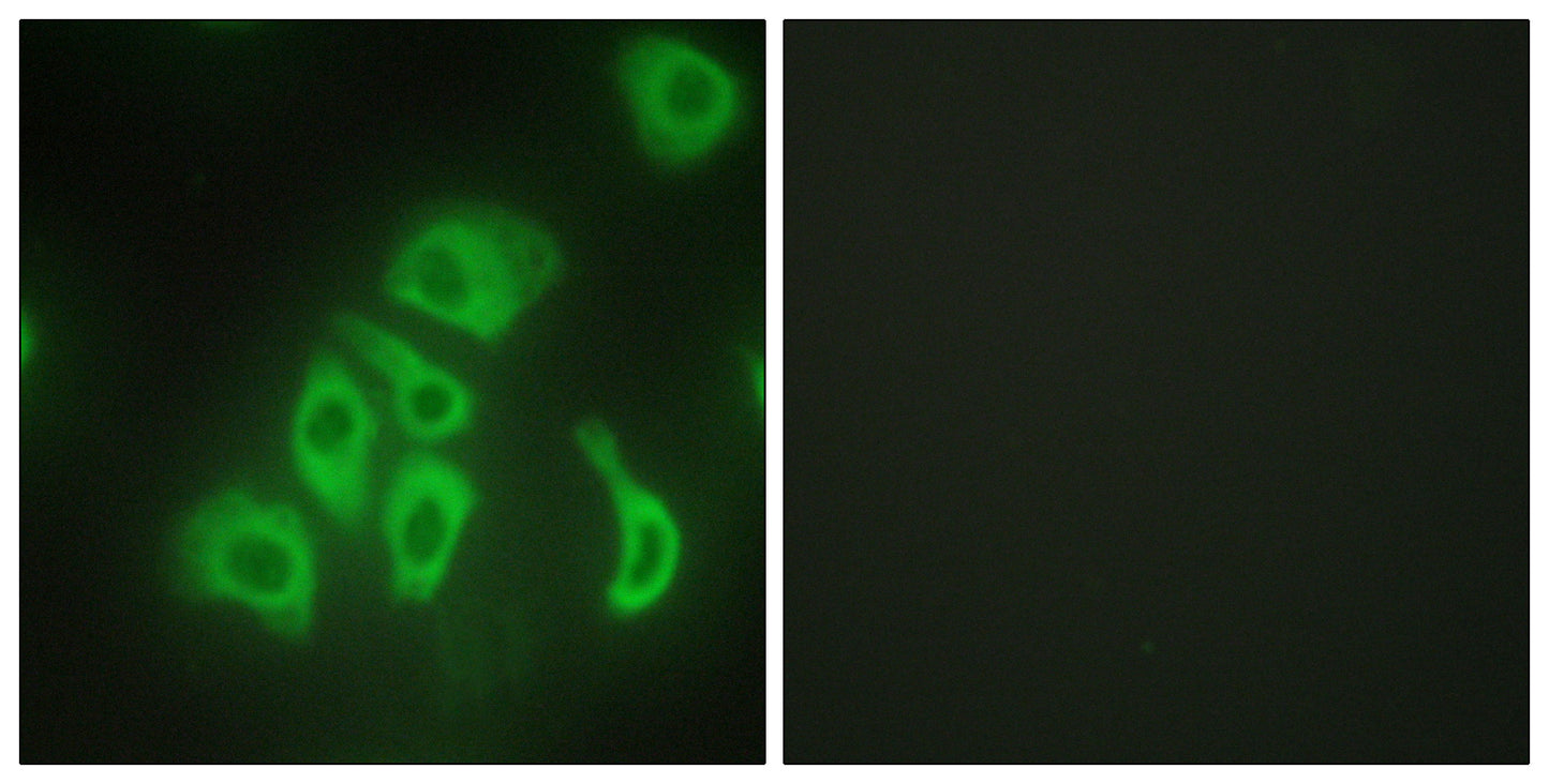 TNF-α Rabbit Polyclonal Antibody