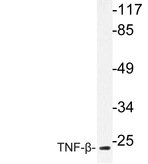 TNF-β Rabbit Polyclonal Antibody