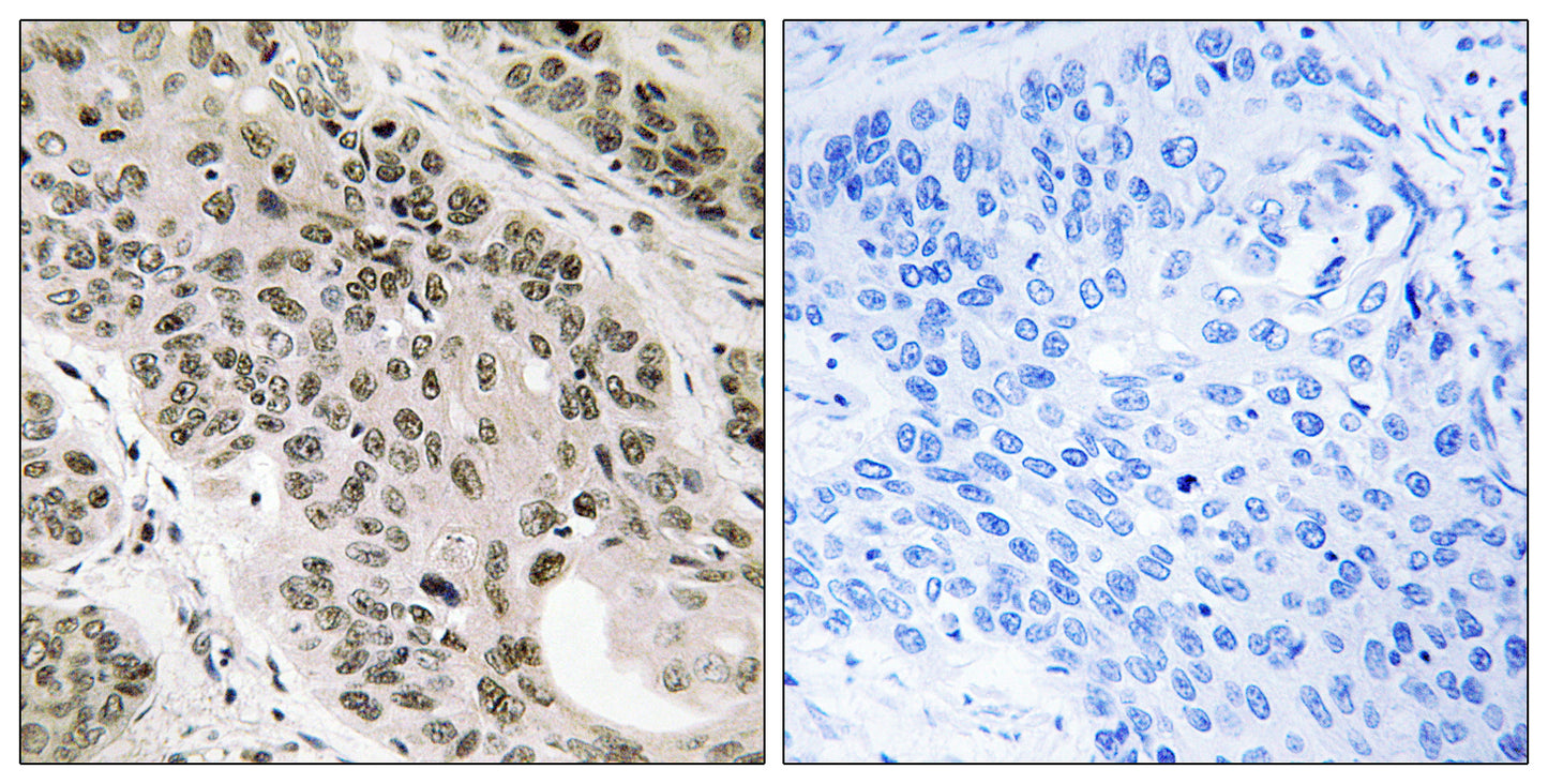 TNNI3K Rabbit Polyclonal Antibody