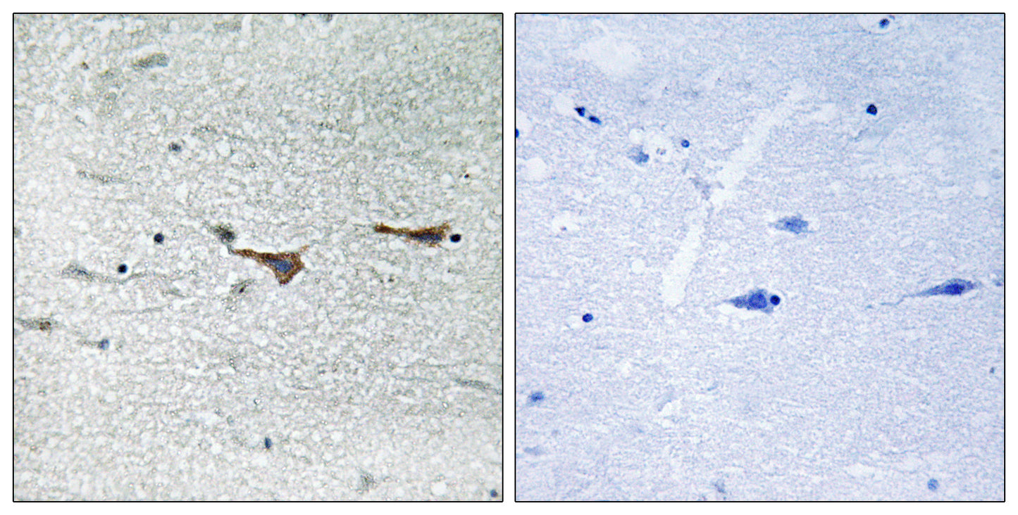 TOB1 Rabbit Polyclonal Antibody