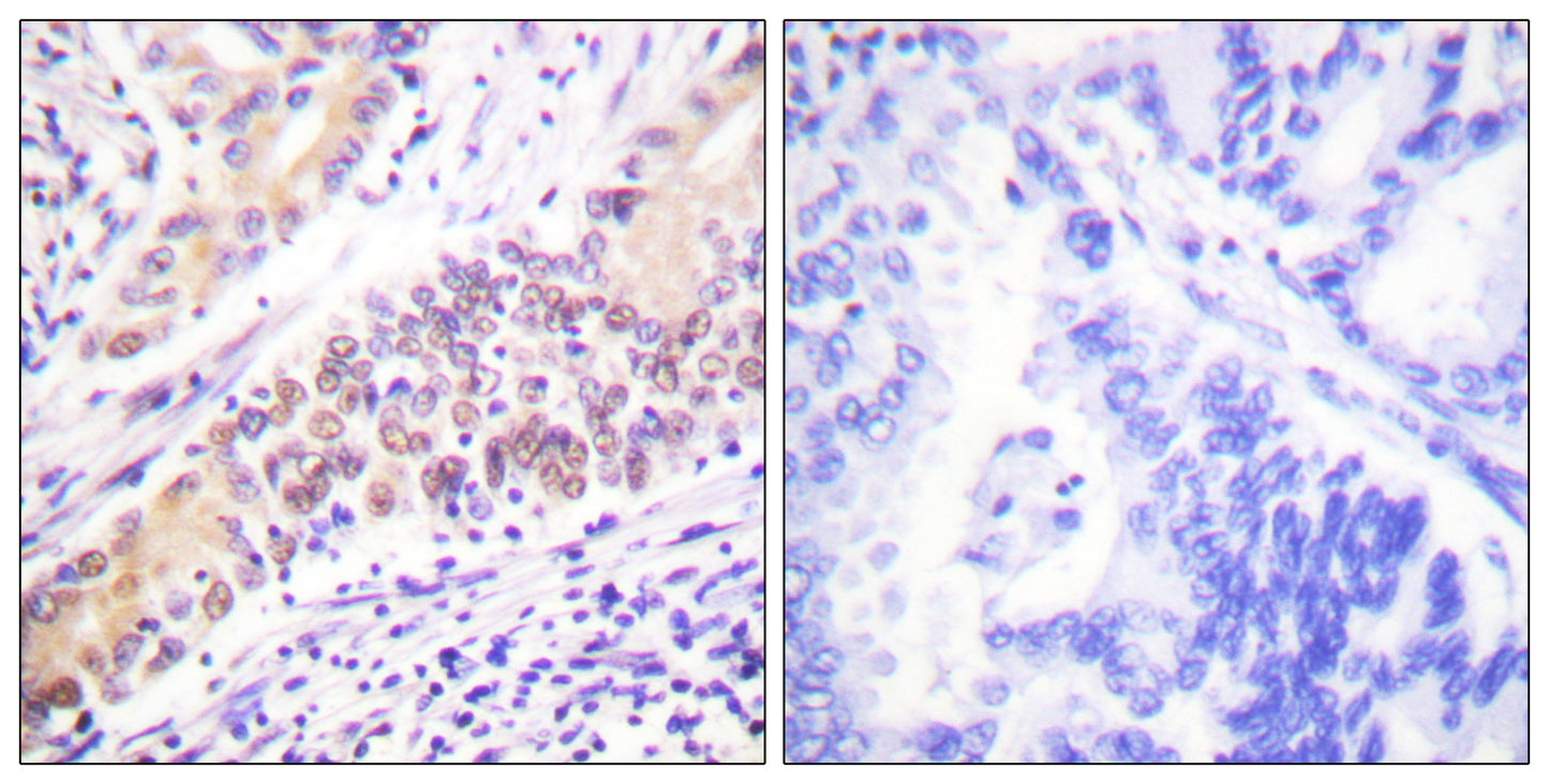 Topo IIβ Rabbit Polyclonal Antibody