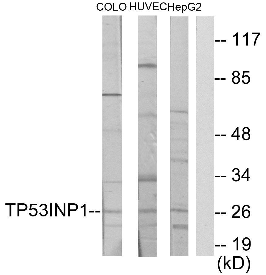 TP53INP1 Rabbit Polyclonal Antibody