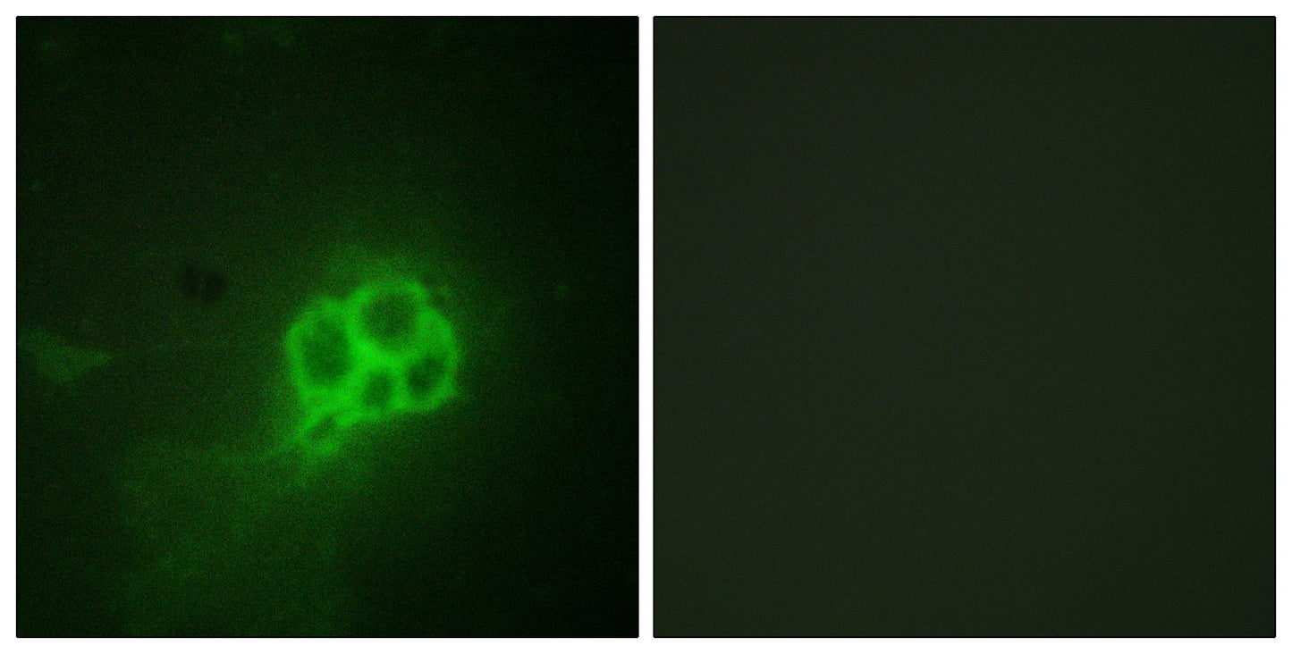 TPH1 Rabbit Polyclonal Antibody