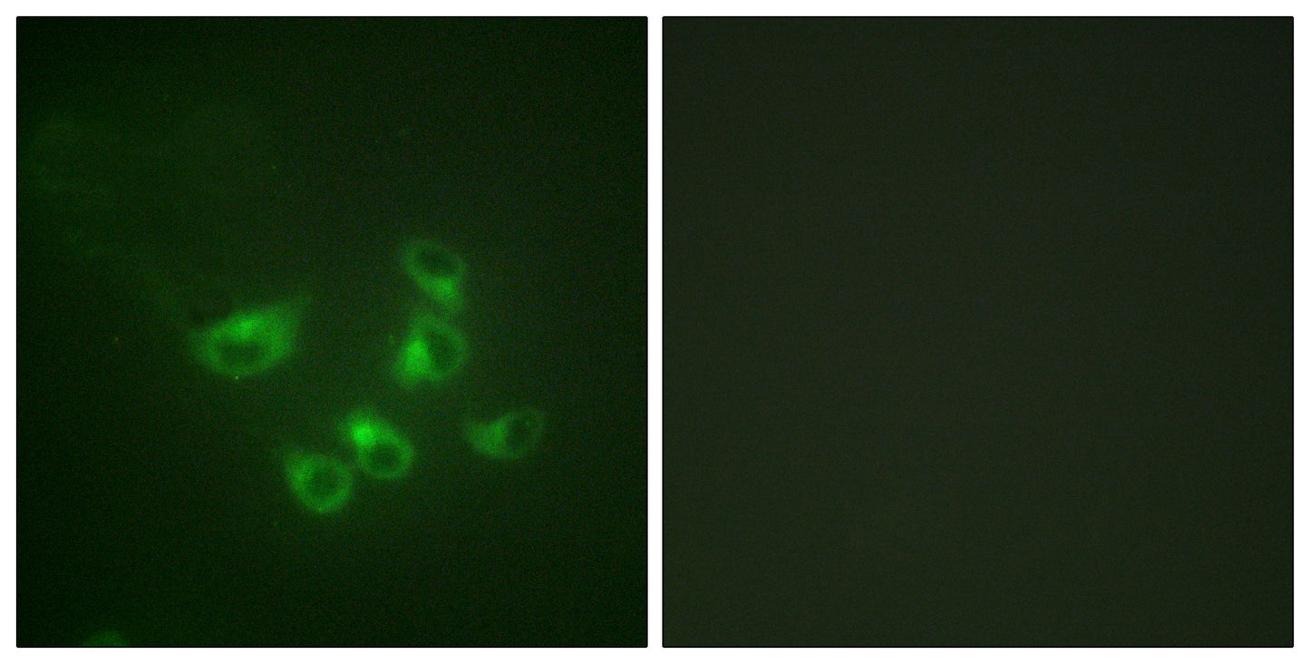 TPH1 Rabbit Polyclonal Antibody