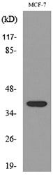 TPO Rabbit Polyclonal Antibody