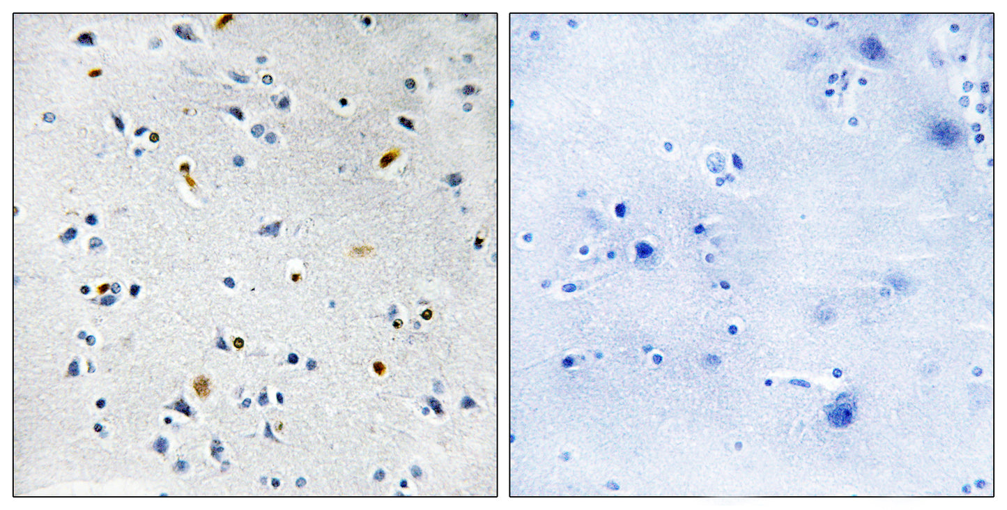 TPX2 Rabbit Polyclonal Antibody