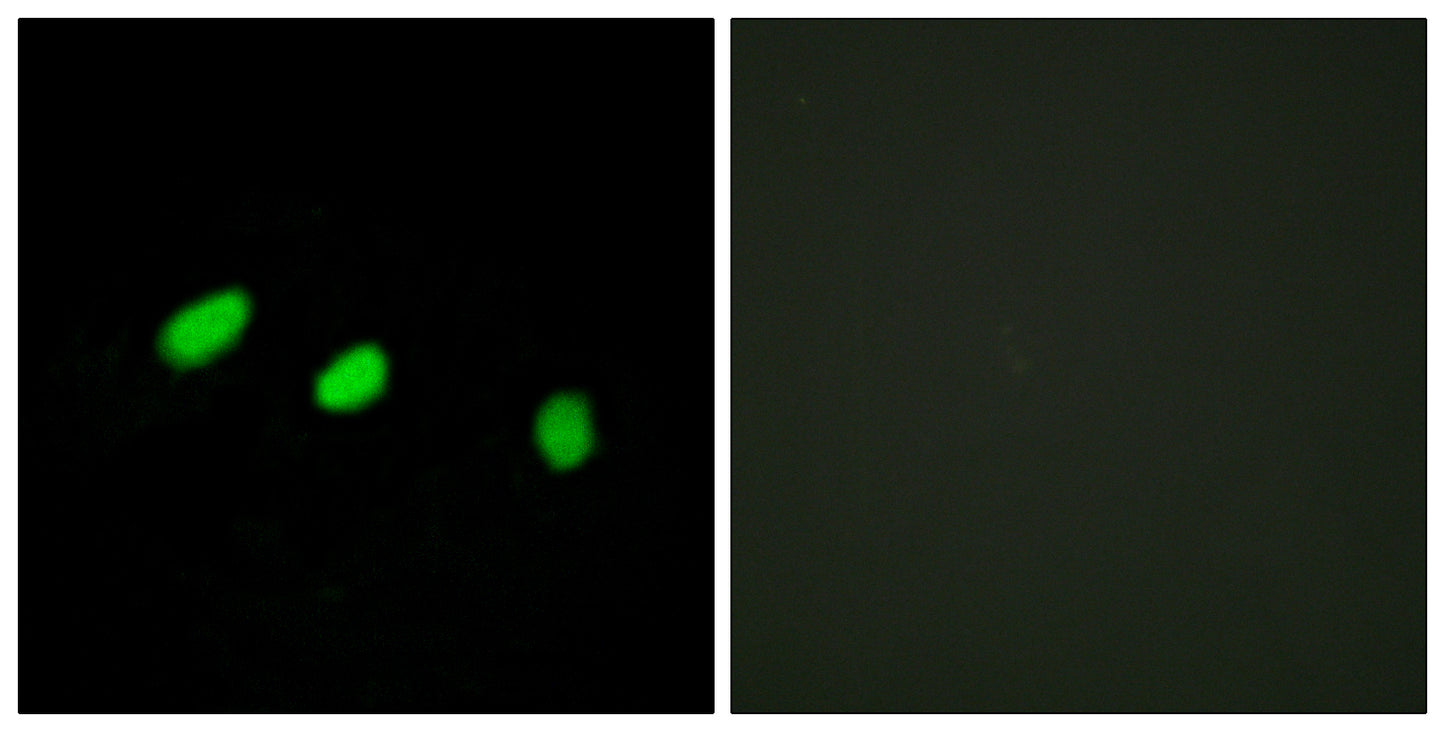 Tra-2α Rabbit Polyclonal Antibody