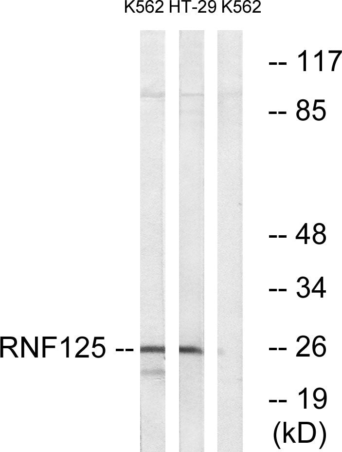 TRAC-1 Rabbit Polyclonal Antibody
