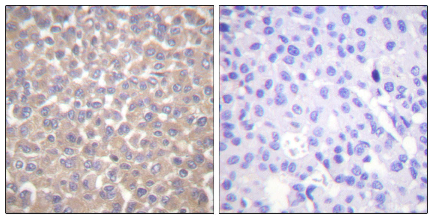 TRADD Rabbit Polyclonal Antibody