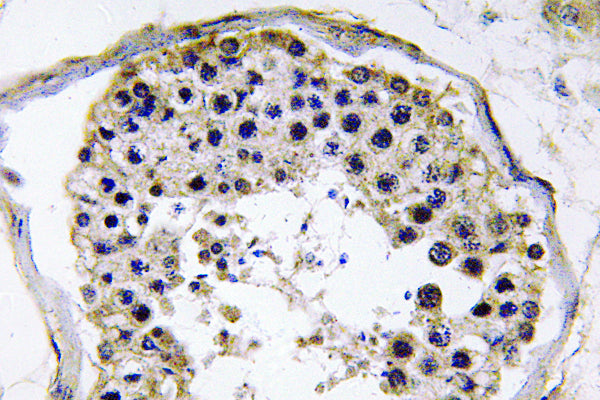 TRAF6 Rabbit Polyclonal Antibody