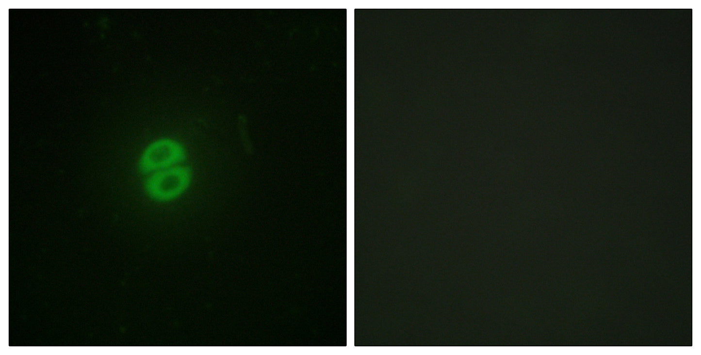 TRAIL Rabbit Polyclonal Antibody