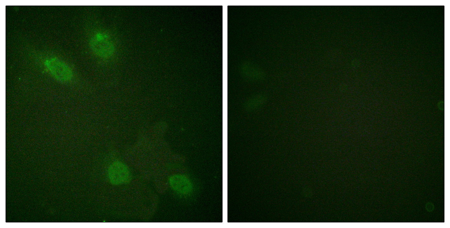 TRAP220 Rabbit Polyclonal Antibody
