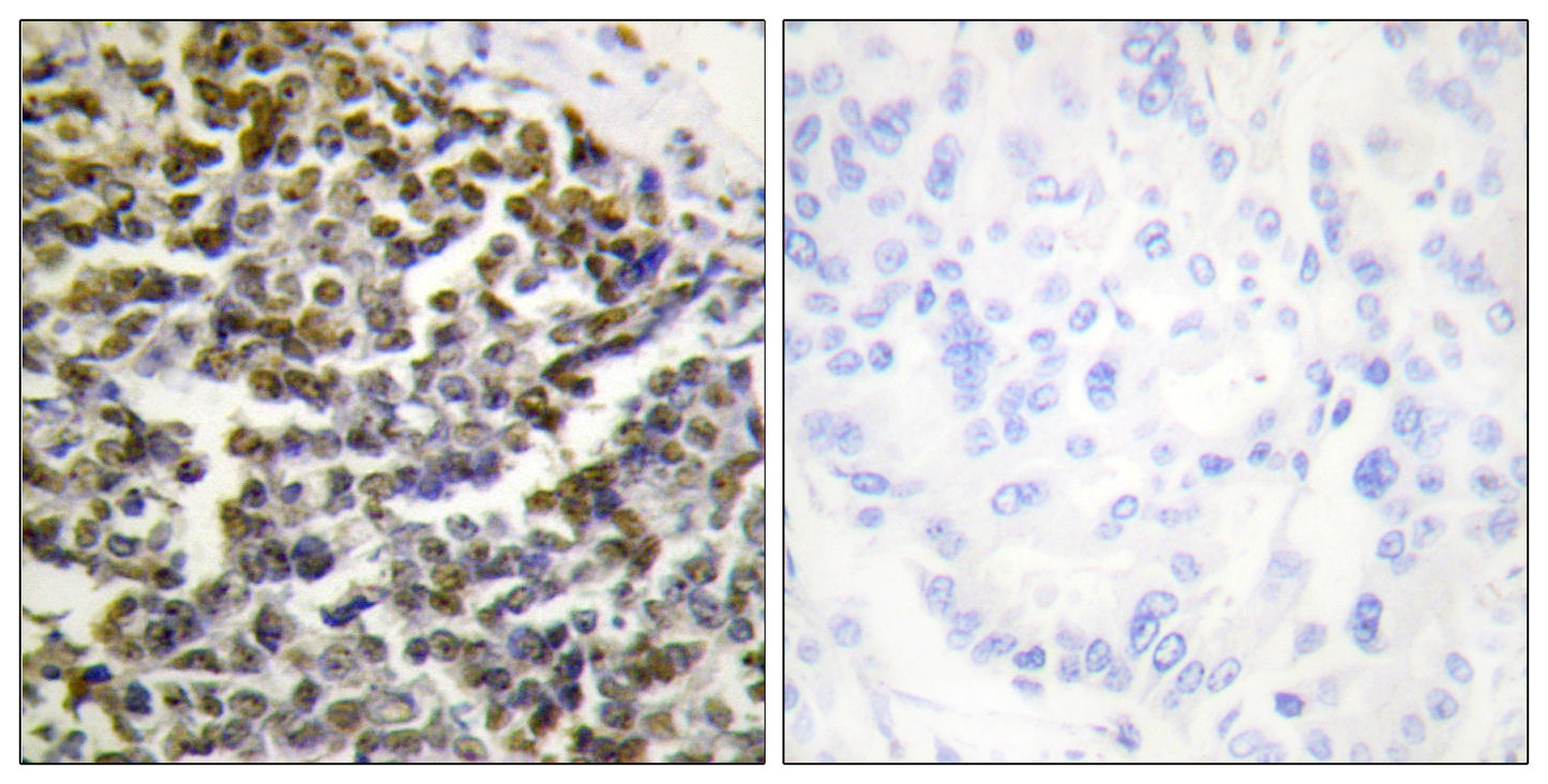 Treacle Rabbit Polyclonal Antibody