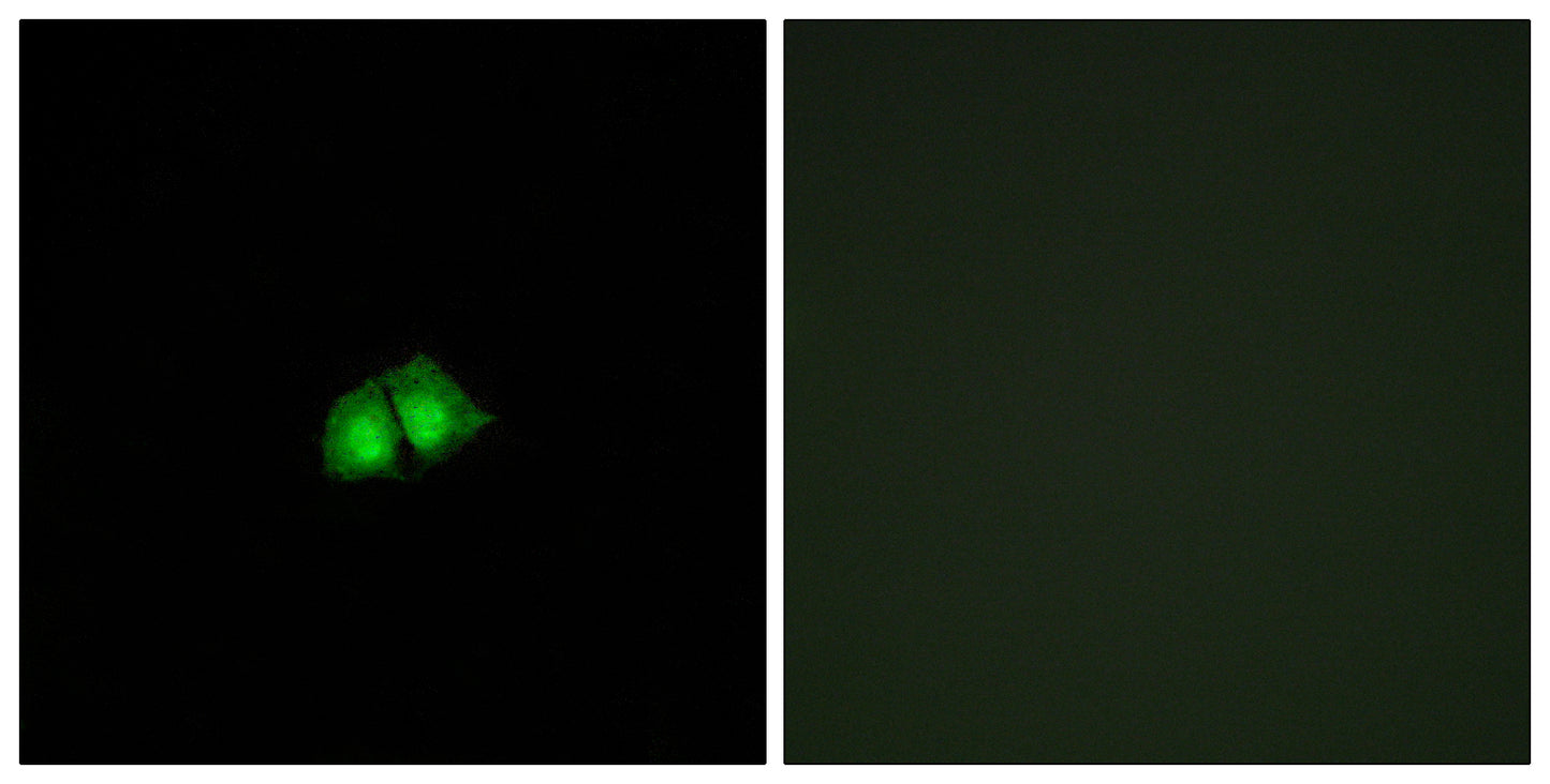 TRIP15 Rabbit Polyclonal Antibody