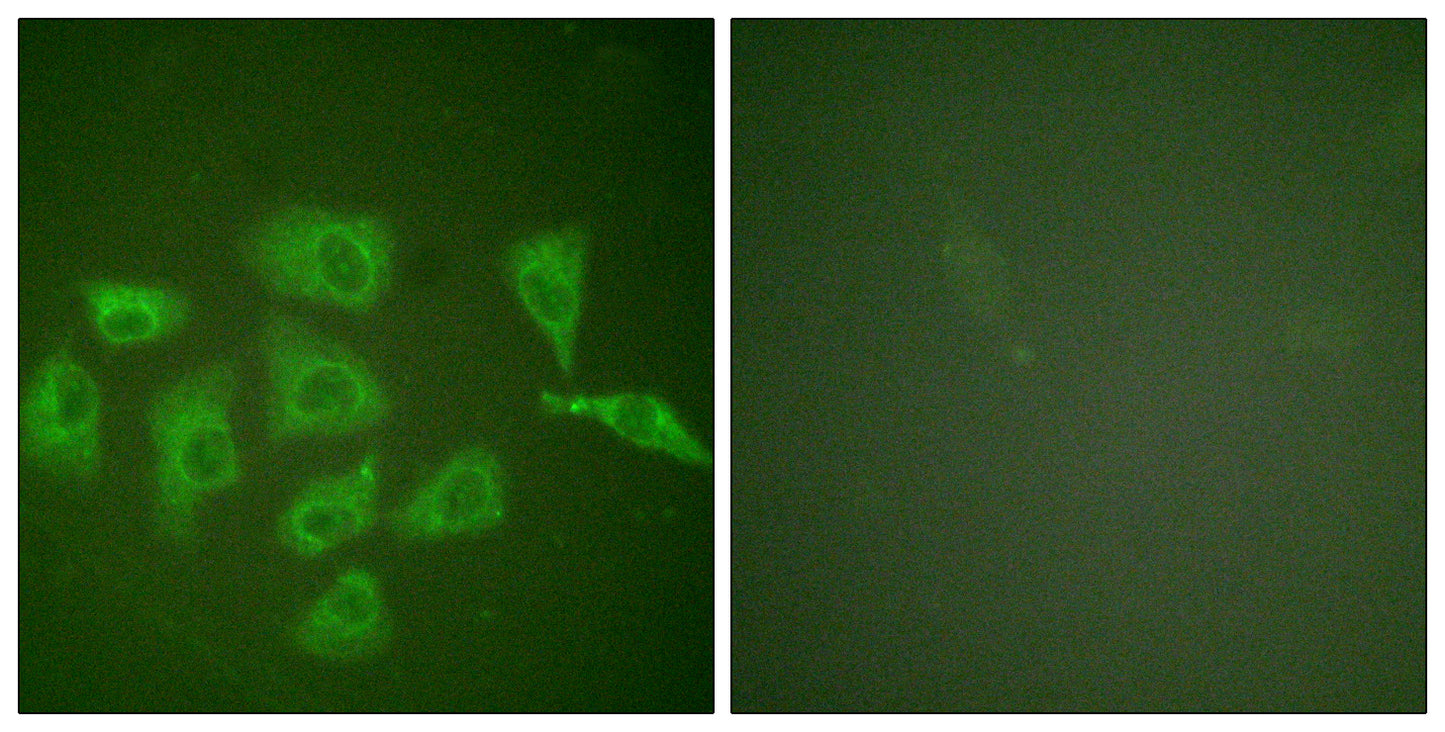 Trk A Rabbit Polyclonal Antibody